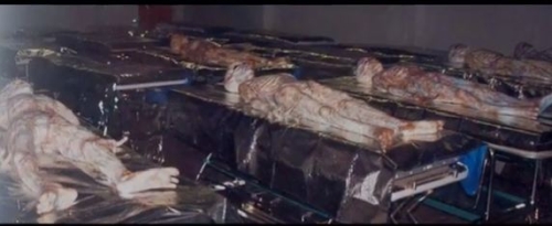 Sectoid autopsy